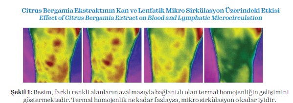 Citrus Bergamia Ekstraktının Kan ve Lenfatik Mikro Sirkülasyon Üzerindeki Etkisi