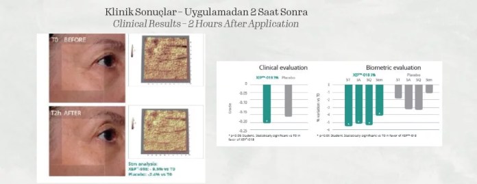 Klinik Sonuçlar – Uygulamadan 2 Saat Sonra